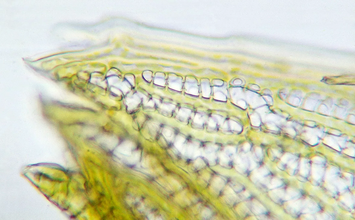 Клеточное строение мхов. Мох сфагнум клетки листа под микроскопом. Клетки листа сфагнума под микроскопом 5 класс. Водоносная ткань сфагнум. Клетки листа сфагнума под микроскопом.